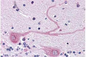 Human Brain, Cerebellum (formalin-fixed, paraffin-embedded) stained with ARMET antibody ABIN343894 at 5 ug/ml followed by biotinylated goat anti-rabbit IgG secondary antibody ABIN481713, alkaline phosphatase-streptavidin and chromogen. (MANF anticorps  (C-Term))
