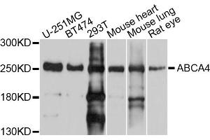 Western blot analysis of extracts of various cell lines, using ABCA4 antibody. (ABCA4 anticorps)
