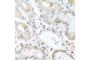 Immunohistochemistry of paraffin-embedded human gastric using RPL36 antibody at dilution of 1:100 (x40 lens). (RPL36 anticorps)