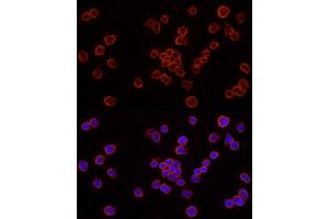 Immunofluorescence analysis of Jurkat cells using Caspase-7 Rabbit pAb (ABIN3022071, ABIN3022072, ABIN3022073 and ABIN6218596) at dilution of 1:250 (40x lens).