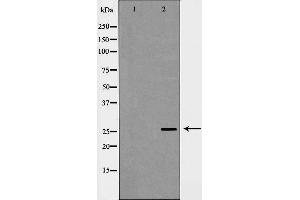 Western blot analysis of extracts of mouse liver, using C1QB antibody. (C1QB anticorps  (Internal Region))