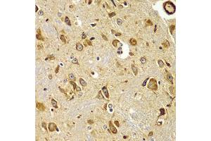 Immunohistochemistry of paraffin-embedded mouse brain using SMAD9 antibody (ABIN5975592) at dilution of 1/100 (40x lens). (SMAD9 anticorps)