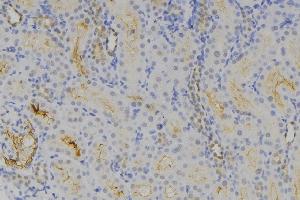 ABIN6275435 at 1/100 staining Human lymph node tissue by IHC-P. (RAB3GAP1 anticorps  (Internal Region))