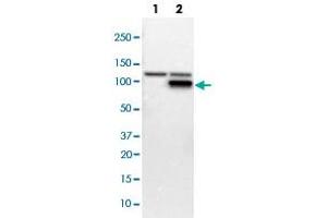 Western blot analysis of Lane 1: NIH-3T3 cell lysate (Mouse embryonic fibroblast cells); Lane 2: NBT-II cell lysate (Rat Wistar bladder tumour cells) with PFKM polyclonal antibody  at 1:100-1:250 dilution. (PFKM anticorps)