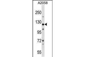 Western blot analysis in A2058 cell line lysates (35ug/lane). (BAT3 anticorps  (C-Term))
