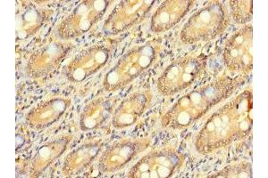 Immunohistochemistry of paraffin-embedded human small intestine tissue using ABIN7176385 at dilution of 1:100