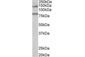 AP31721PU-N EPB41L5 antibody staining of Human Brain (Hippocampus) lysate at 1 µg/ml (35 µg protein in RIPA buffer). (EPB41L5 anticorps  (Internal Region))