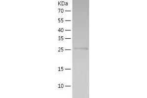 Western Blotting (WB) image for Aldo-keto Reductase Family 1, Member C2 (AKR1C2) (AA 1-256) protein (His tag) (ABIN7121783) (AKR1C2 Protein (AA 1-256) (His tag))