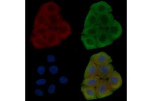 ABIN6262527 and ABIN6278482 staining Hela cells(30 min of UV treatment) by IF/ICC. (IL32 anticorps  (Internal Region))