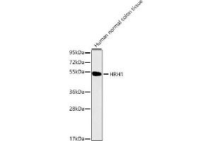 Western blot analysis of extracts of Human normal colon tissue, using HRH1 antibody (ABIN1680348, ABIN3015480, ABIN3015481 and ABIN7101436). (HRH1 anticorps)