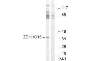 Western blot analysis of extracts from Jurkat cells, using ZDHHC15 antibody. (ZDHHC15 anticorps  (C-Term))