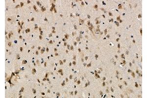 ABIN6263167 and ABIN6276541 at 1/100 staining Rat brain tissue by IHC-P. (MCM7 anticorps  (Internal Region))