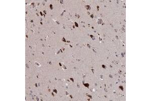Immunohistochemical staining of human cerebral cortex with ADO polyclonal antibody  shows strong cytoplasmic positivity in neuronal cells.