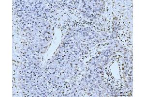 IHC analysis of KIFC1 using anti-KIFC1 antibody (ABIN7599523). (KIFC1 anticorps  (AA 1-673))