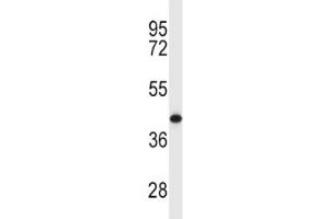 MCL1 antibody western blot analysis in Y79 lysate.