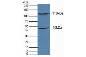 Detection of KIF18A in Human Hela Cells using Polyclonal Antibody to Kinesin Family, Member 18A (KIF18A) (KIF18A anticorps  (AA 1-453))