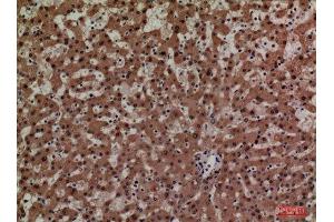 Immunohistochemistry (IHC) analysis of paraffin-embedded Human Liver, antibody was diluted at 1:100.