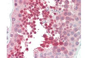 Anti-YBX3 / CSDA antibody IHC staining of human testis.