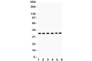 Western blot testing of Rad51 antibody and Lane 1:  22RV1;  2: SW620;  3: PANC;  4: U87;  5: CEM;  6: MM231. (RAD51 anticorps  (AA 1-258))