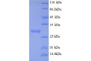 SDS-PAGE (SDS) image for Collagen, Type IV, alpha 3 (COL4A3) (AA 1446-1667), (partial) protein (His tag) (ABIN5709311)