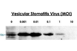 24-hour post infection immunoblots of whole cell lysates from primary murine microglia cells (2x10 6 ) untreated (0) or exposed to vesicular stomatitis virus at a range of viral particle/cell ratios. (DDX58 anticorps  (C-Term))