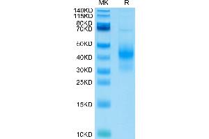 Human NKG2D on Tris-Bis PAGE under reduced condition. (KLRK1 Protein (AA 78-216) (His-Avi Tag))
