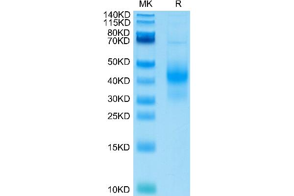 KLRK1 Protein (AA 78-216) (His-Avi Tag)