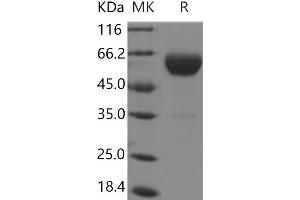 Western Blotting (WB) image for Carboxypeptidase B2 (Plasma) (CPB2) protein (His tag) (ABIN7321061) (CPB2 Protein (His tag))