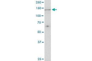 UBE4A monoclonal antibody (M08), clone 1G8. (UBE4A anticorps  (AA 974-1073))