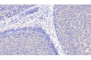 Detection of IL6R in Human Lymph node Tissue using Polyclonal Antibody to Interleukin 6 Receptor (IL6R) (IL-6 Receptor anticorps  (AA 216-356))