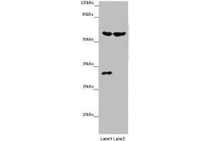 Western blot All lanes: TERF2 antibody at 14 μg/mL Lane 1: Mouse thymus tissue Lane 2: MCF-7 whole cell lysate Secondary Goat polyclonal to rabbit IgG at 1/10000 dilution Predicted band size: 60, 33 kDa Observed band size: 60, 31 kDa
