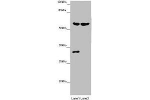 Western blot All lanes: TERF2 antibody at 14 μg/mL Lane 1: Mouse thymus tissue Lane 2: MCF-7 whole cell lysate Secondary Goat polyclonal to rabbit IgG at 1/10000 dilution Predicted band size: 60, 33 kDa Observed band size: 60, 31 kDa (TRF2 anticorps  (AA 78-238))