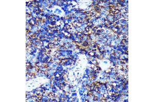 Immunohistochemistry of paraffin-embedded Rat spleen using HEBP2 Rabbit pAb (ABIN7267604) at dilution of 1:100 (40x lens).