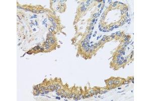 Immunohistochemistry of paraffin-embedded Human prostate using ARL6 Polyclonal Antibody at dilution of 1:100 (40x lens). (ARL6 anticorps)
