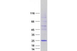 Validation with Western Blot (C5ORF49 Protein (Myc-DYKDDDDK Tag))