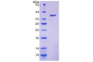SDS-PAGE (SDS) image for Loricrin (LOR) (AA 210-295) protein (His tag,GST tag) (ABIN1981092) (LOR Protein (AA 210-295) (His tag,GST tag))