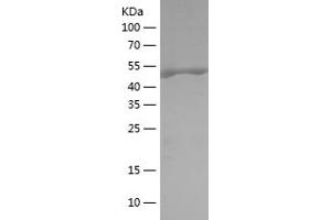 Western Blotting (WB) image for 3-phosphoinositide Dependent Protein Kinase-1 (PDPK1) (AA 351-556) protein (His-IF2DI Tag) (ABIN7121615)