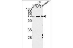 ATF6B anticorps  (C-Term)