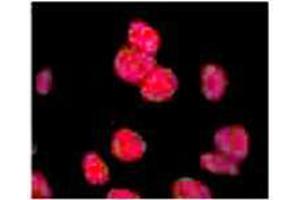 Anti-ATM Monoclonal Antibody - Immunofluorescence Anti ATM Antibody showing overlay of anti-ATM pS1981 staining. (ATM anticorps  (pSer1981) (HRP))