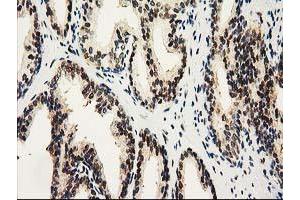 Image no. 5 for anti-Nonhomologous End-Joining Factor 1 (NHEJ1) antibody (ABIN1499729) (NHEJ1 anticorps)