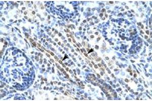 Immunohistochemical staining (Formalin-fixed paraffin-embedded sections) of human kidney with ANKRD11 polyclonal antibody  at 4-8 ug/mL working concentration. (ANKRD11 anticorps  (N-Term))
