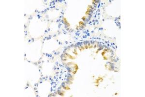 Immunohistochemistry of paraffin-embedded mouse lung using KLK11 antibody (ABIN6129403, ABIN6142946, ABIN6142948 and ABIN6216242) at dilution of 1:100 (40x lens).