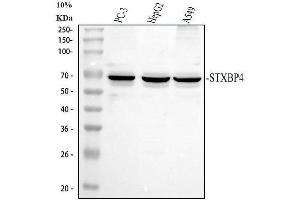 Western blot analysis of Synip/STXBP4 using anti-Synip/STXBP4 antibody (ABIN7602066).