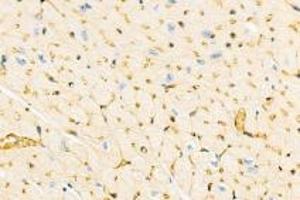 Immunohistochemistry analysis of paraffin-embedded mouse heart using,DMPK (ABIN7073790) at dilution of 1: 2000