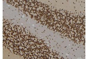 ABIN6267647 at 1/100 staining Rat brain tissue by IHC-P.