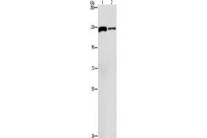 Western Blotting (WB) image for anti-ATP Citrate Lyase (ACLY) antibody (ABIN2429586) (ACLY anticorps)