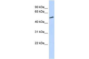 Transfected 293T; WB Suggested Anti-IKZF2 Antibody Titration: 0.