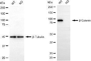 Western blotting analysis using beta catenin antibody (ABIN7797936).