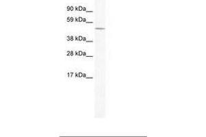 Image no. 1 for anti-Ceramide Synthase 4 (CERS4) (AA 49-98) antibody (ABIN202416) (LASS4 anticorps  (AA 49-98))