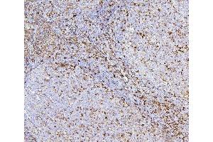 IHC analysis of CD43 using anti-CD43 antibody (ABIN7601042). (CD43 anticorps  (AA 272-400))